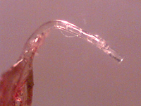 Larsoncochlear36