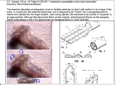 Larsoninjectedimplant